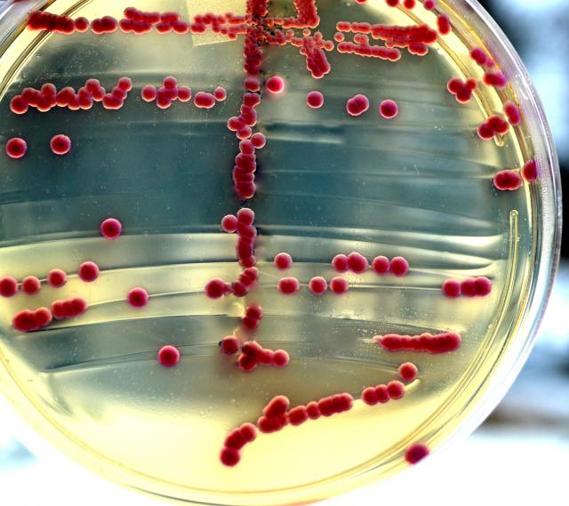Pronaðen lek protiv bakterija otpornih na antibiotike?